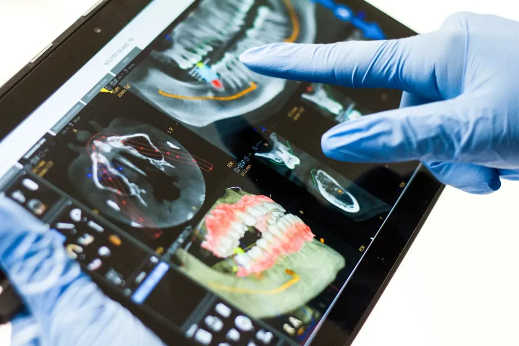 Dlaczego diagnostyka obrazowa jest podstawą dla skutecznego leczenia stomatologicznego?