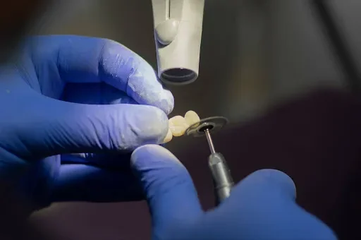 Proteza ruchoma czy stała? Wyjaśniamy, czym naprawdę jest proteza na implantach